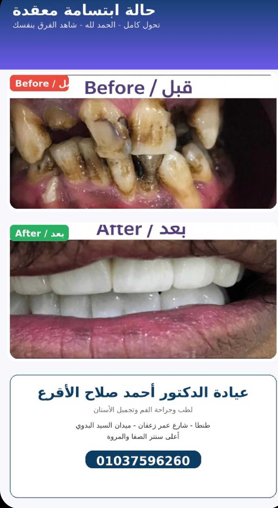 عيادة الدكتور أحمد صلاح الأقرع لطب وجراحة وتجميل الاسنان