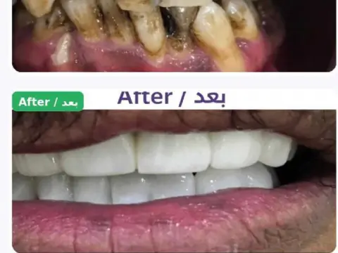 عيادة الدكتور أحمد صلاح الأقرع لطب وجراحة وتجميل الاسنان